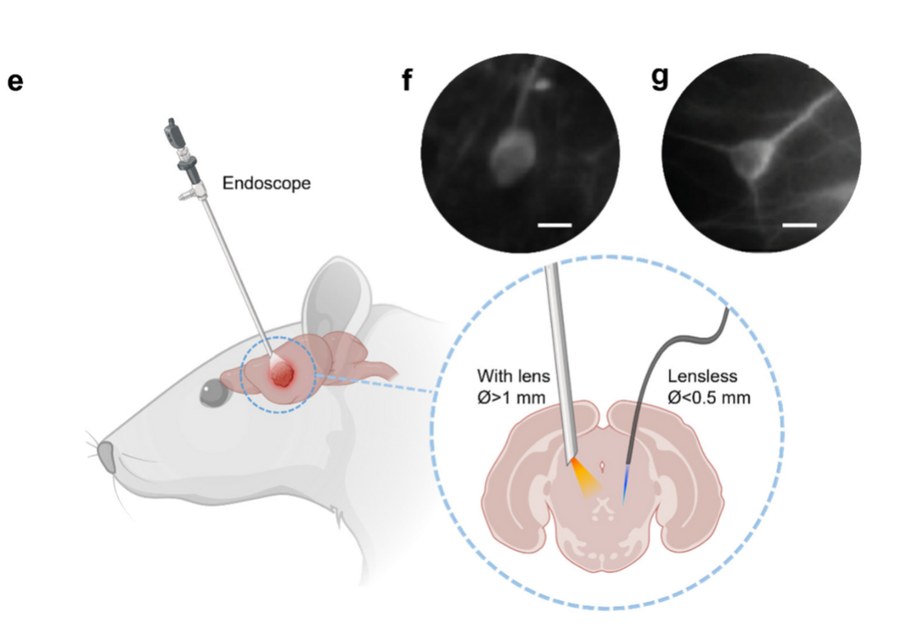In vivo lensless fiber endomicroscopy comparison