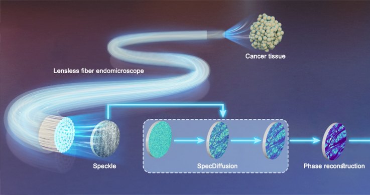 Lensless fiber endomicroscopy phase reconstruction pipeline
